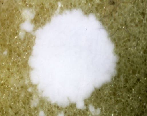 Konyaite mineral
